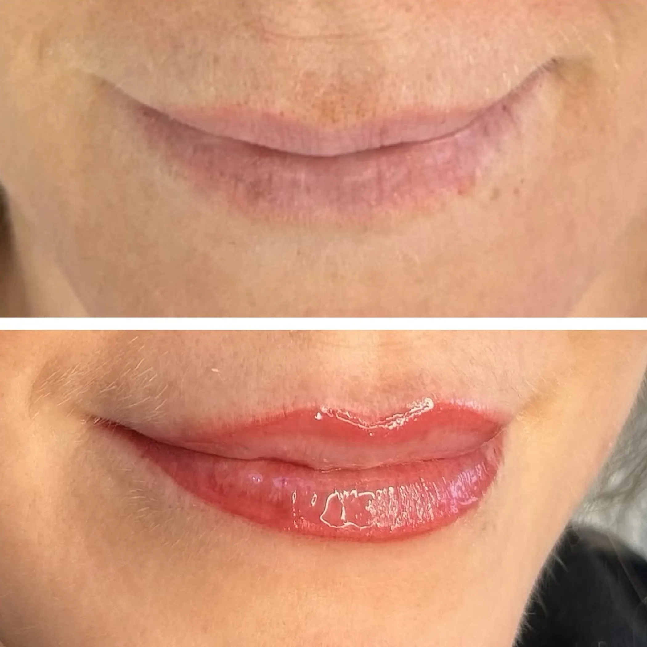 close-up of lips with pigment correction