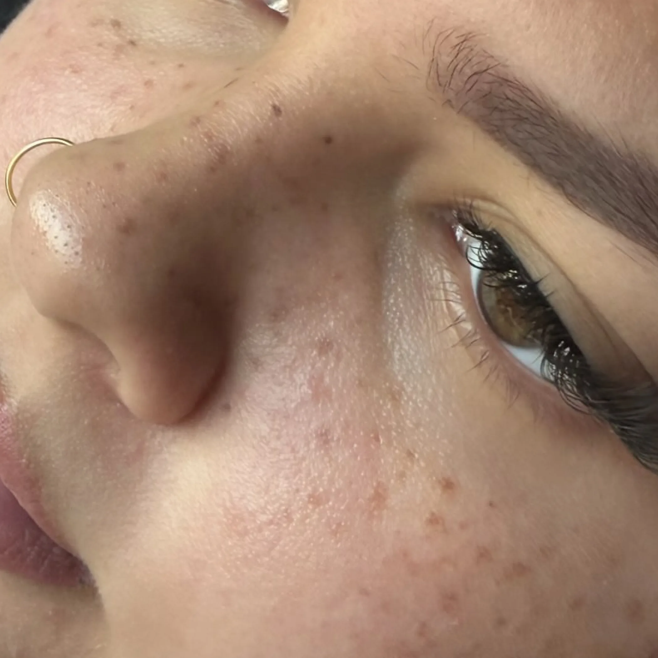 close-up of cosmetic tattoo freckles